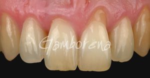 Periodoncia Clínica Tratamientos Dental Dr. Gamborena