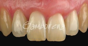 Periodoncia Tratamientos Clínica  Dental Dr. Gamborena